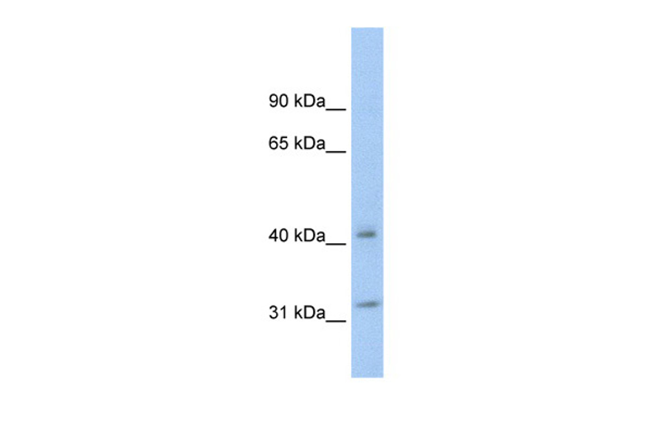 Antibody used in WB on Human SW620 cells at 0.2-1 ug/ml.