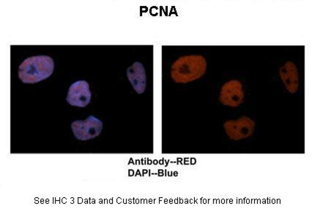 Antibody used in IHC on Human brain stem at: 1:50.