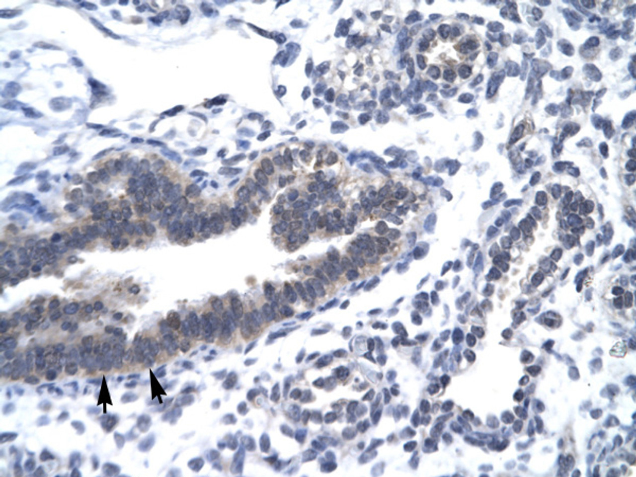 Antibody used in IHC on Human Lung.