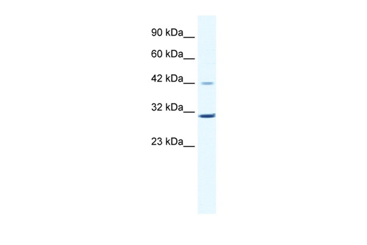 Antibody used in WB on Human Jurkat 0.2-1 ug/ml.