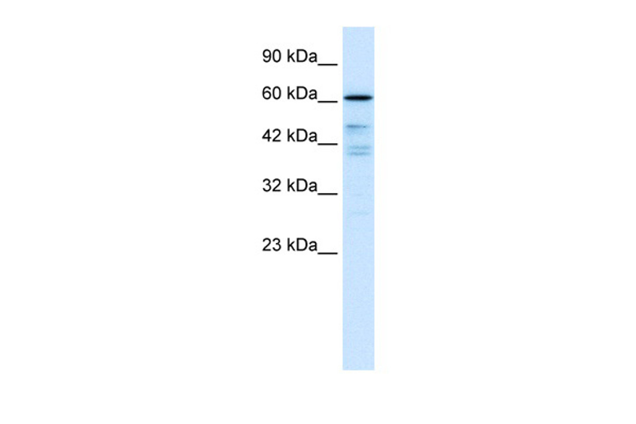 Antibody used in WB on Human Daudi at 0.2-1 ug/ml.