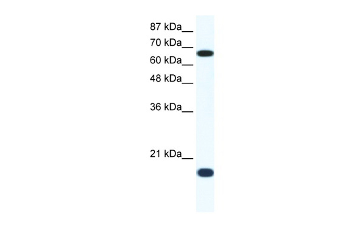 Antibody used in WB on Human Jurkat 1.25 ug/ml.