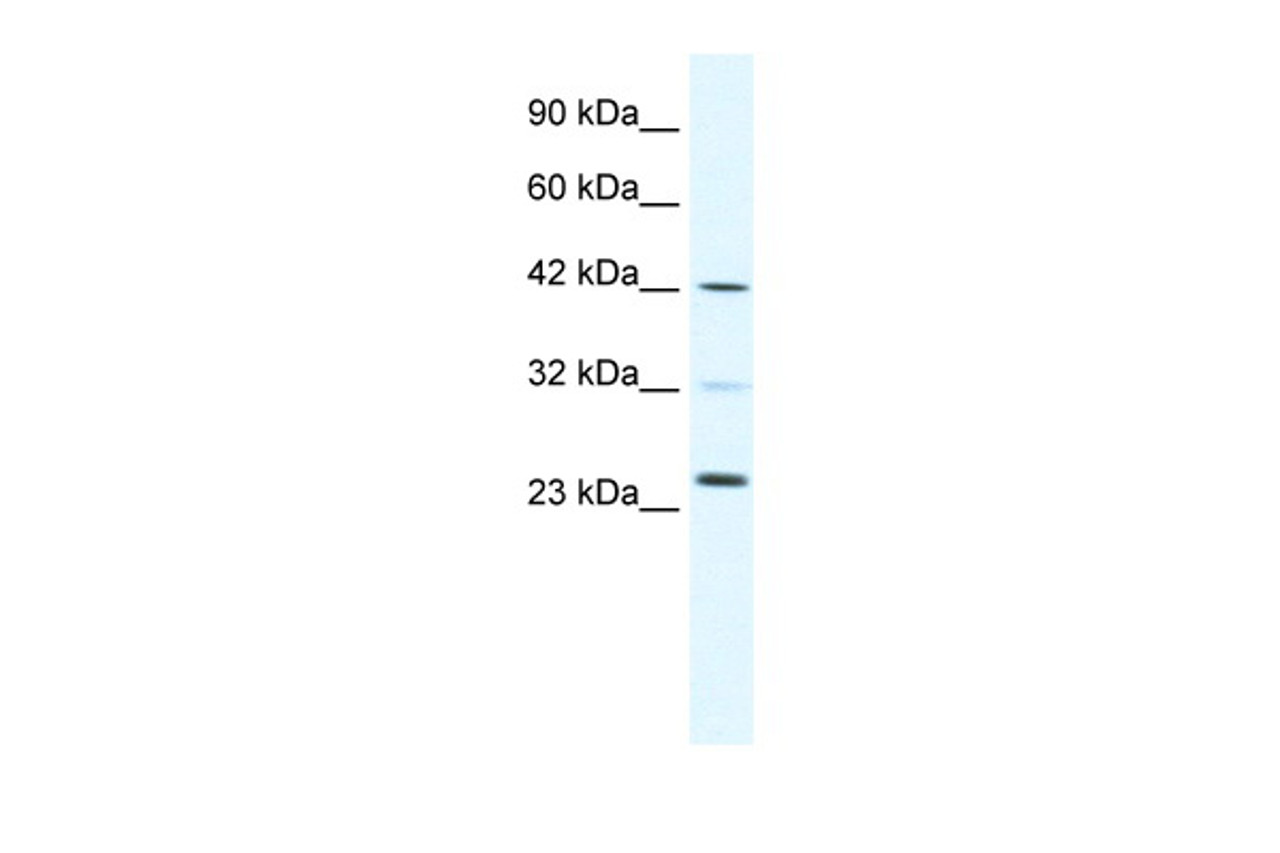 Antibody used in WB on Human Daudi cells at 0.2-1 ug/ml.