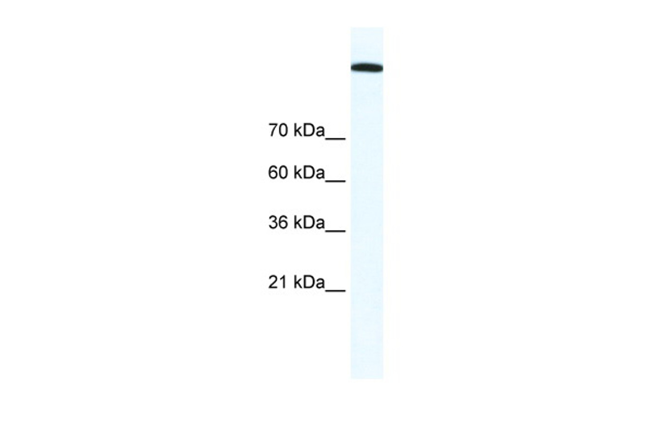 Antibody used in WB on Human HepG2 at 1.25 ug/ml.