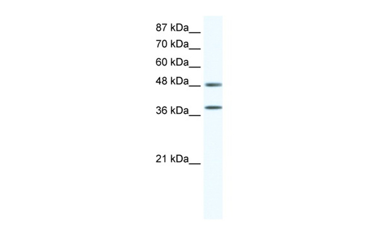 Antibody used in WB on Human Jurkat cells at 0.625 ug/ml.