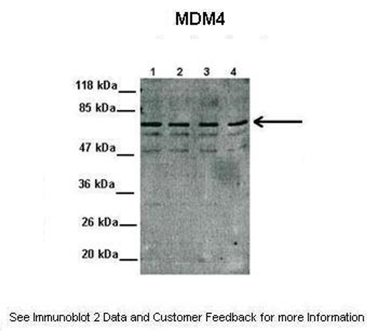 Antibody used in WB on Human MCF-7 at 1:1000 (Lanes 1-4: 10 ug MCF7 cell lysate) .