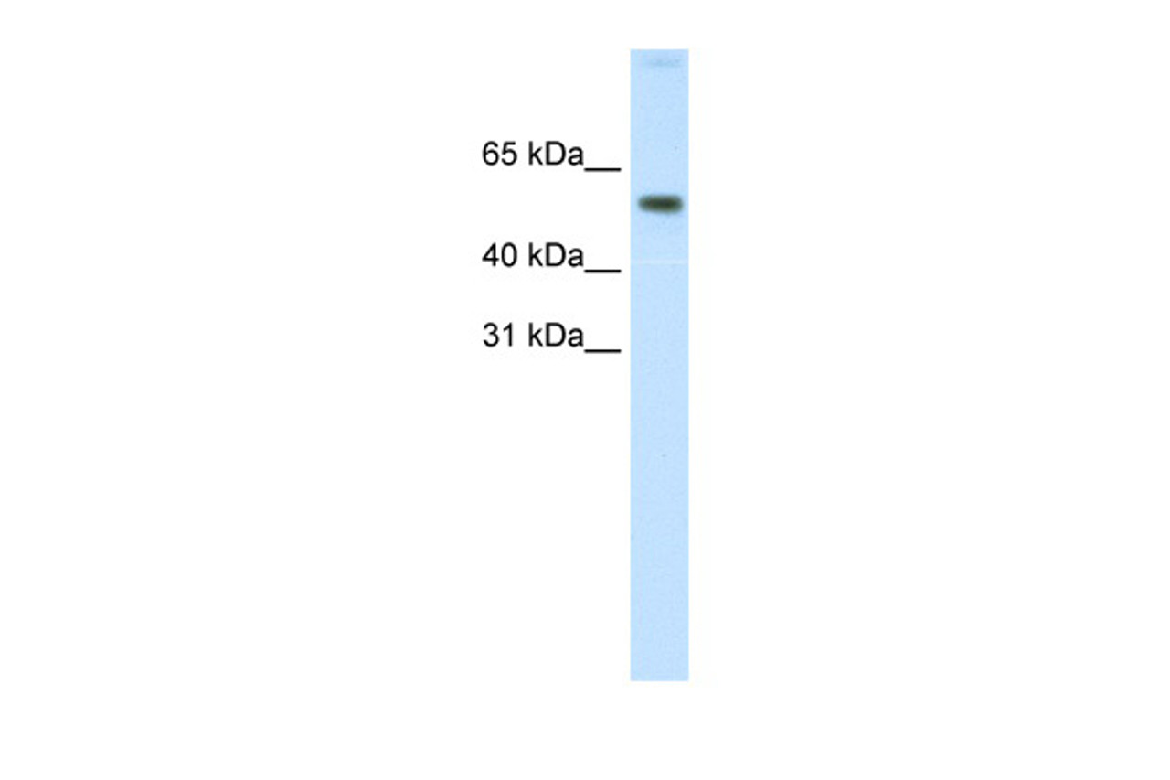 Antibody used in WB on Human Small Intestine at 0.2-1 ug/ml.