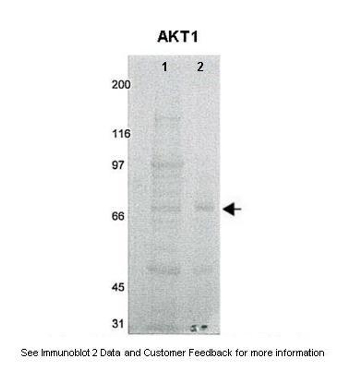 Antibody used in WB on Xenopus laevis embryos at: 1:500 (Lanes: 1. 50 ug xenopus laevis embryos lysate (lysate buffer) 2. 50 ug xenopus laevis embryos lysate (HB buffer) ) .