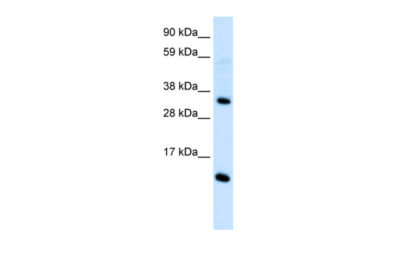 Antibody used in WB on Human Thymus at 0.2-1 ug/ml.