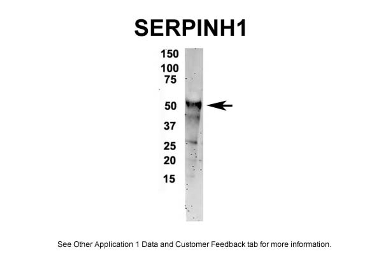 Antibody used in IP on Mouse brain at 1:500.