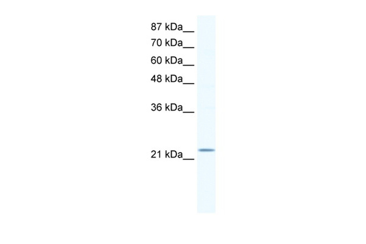 Antibody used in WB on Human Jurkat 1.25 ug/ml.