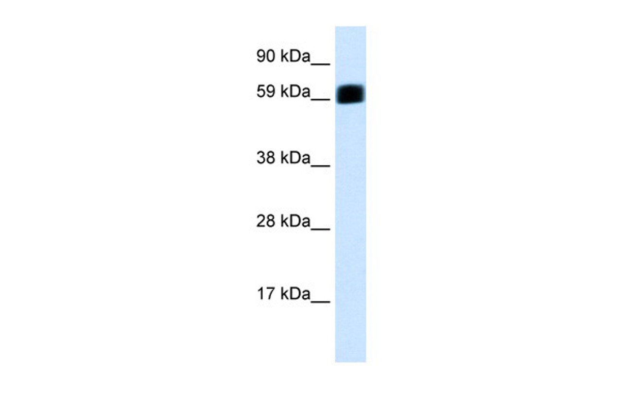 Antibody used in WB on Human Stomach at 0.125 ug/ml.