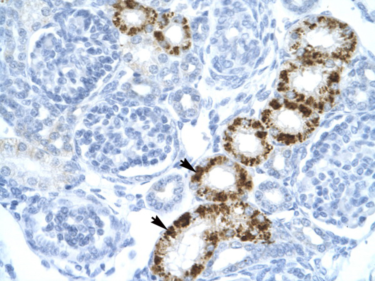 Antibody used in IHC on Human kidney.