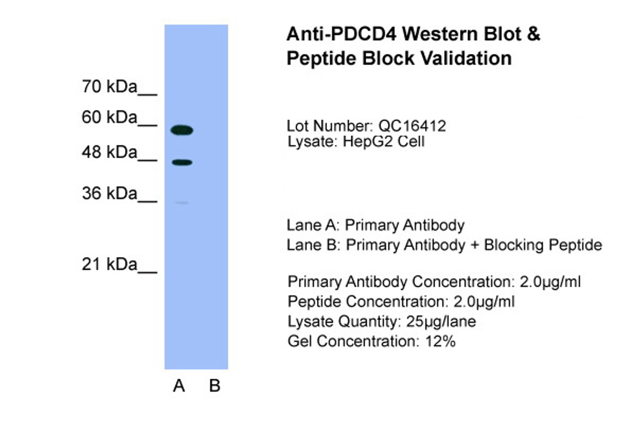 Antibody used in WB on HepG2 at 2.0 ug/ml (Lane A: Primary Antibody and Lane B: Primary Antibody + Blocking Peptide ) .