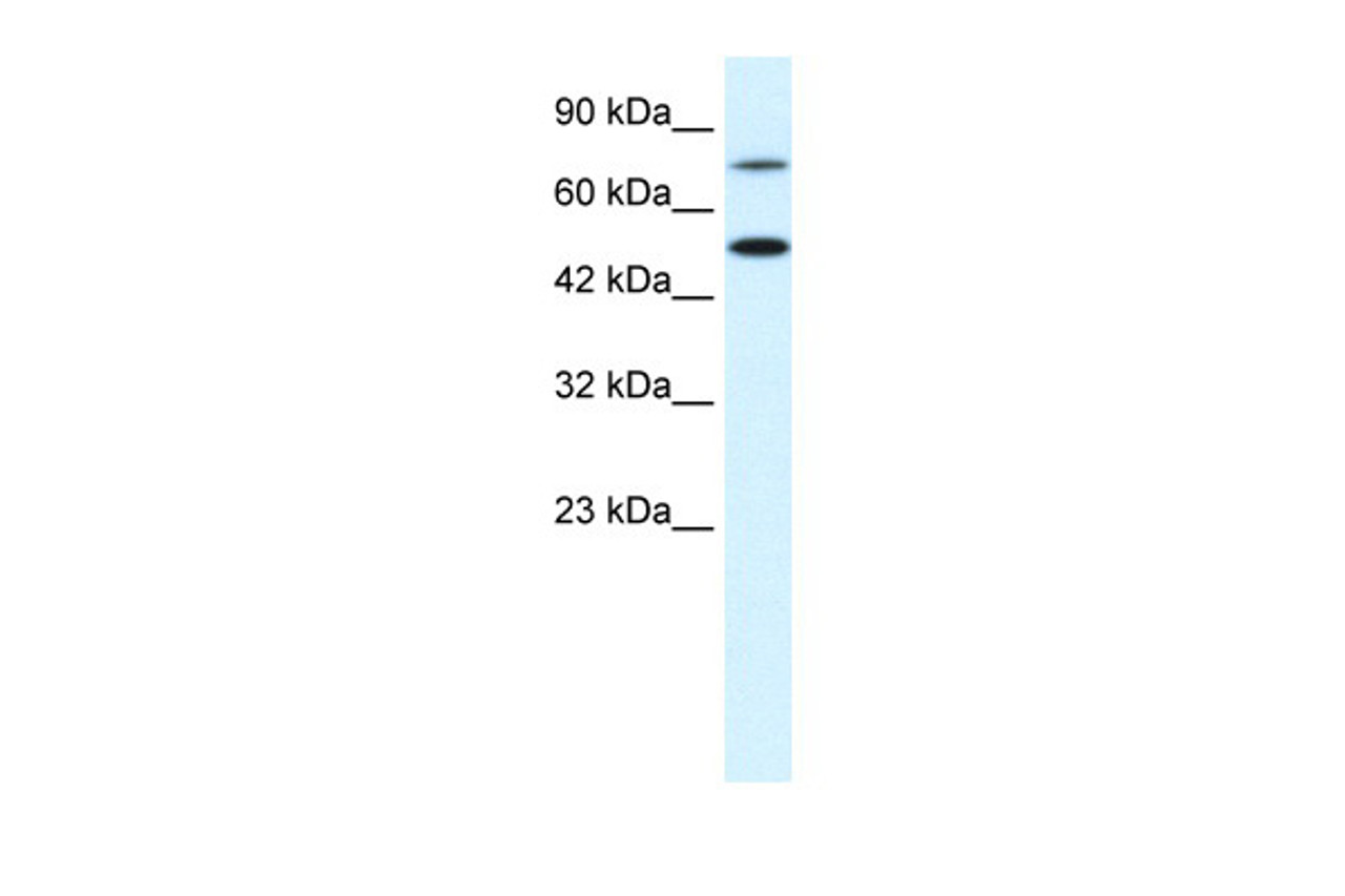 Antibody used in WB on Human Jurkat 0.05 ug/ml.