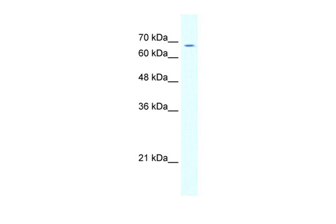 Antibody used in WB on Human cell lines at 5.0 ug/ml.
