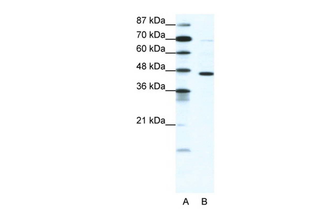 Antibody used in WB on Human cell lines at 1.25 ug/ml.
