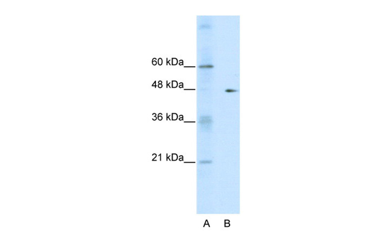 Antibody used in WB on Human HepG2 cells at 0.2-1 ug/ml.