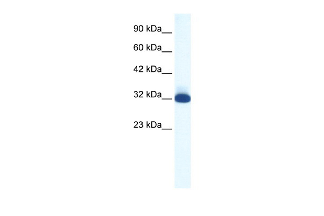 Antibody used in WB on Human HepG2 at 1.25 ug/ml.