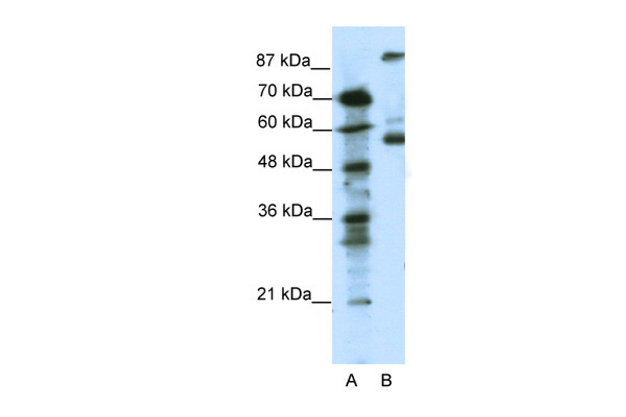 Antibody used in WB on Human Jurkat 0.125 ug/ml.