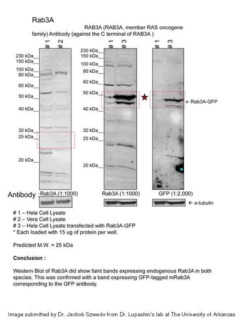 Antibody used in WB on Human Fetal Brain at 1.25 ug/ml.