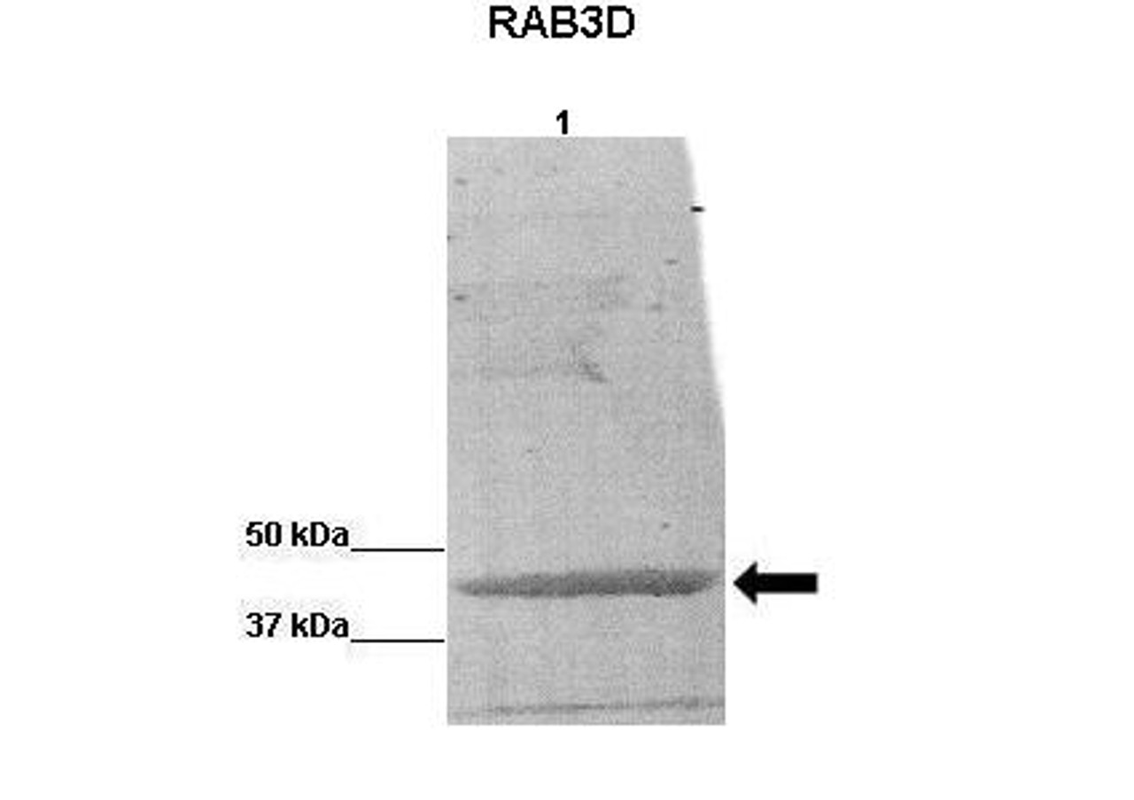 Antibody used in WB on BCAM0379 protein from B cenocepacia at 1:5000.