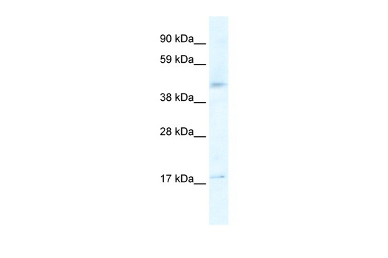 Antibody used in WB on Human Liver at 2.5 ug/ml.