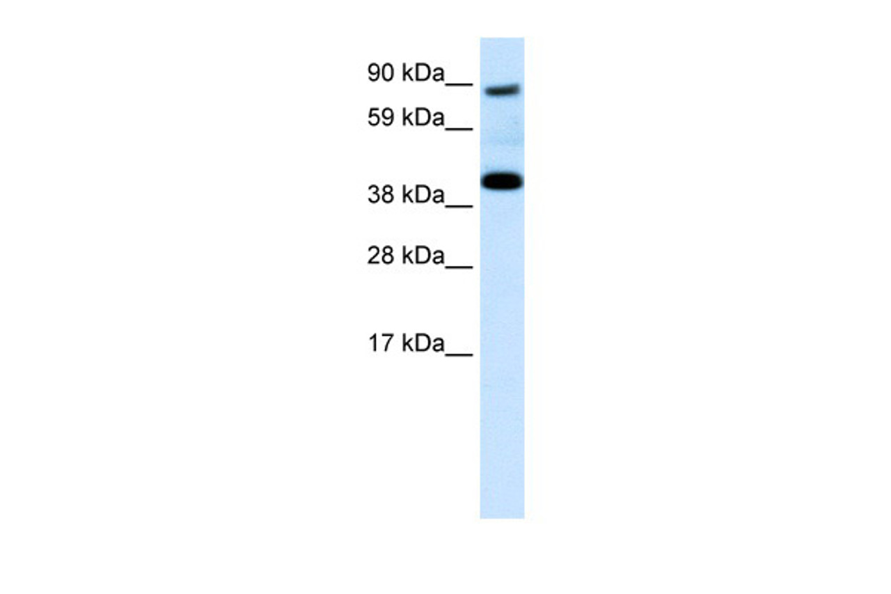 Antibody used in WB on Human Placenta at 0.2-1 ug/ml.