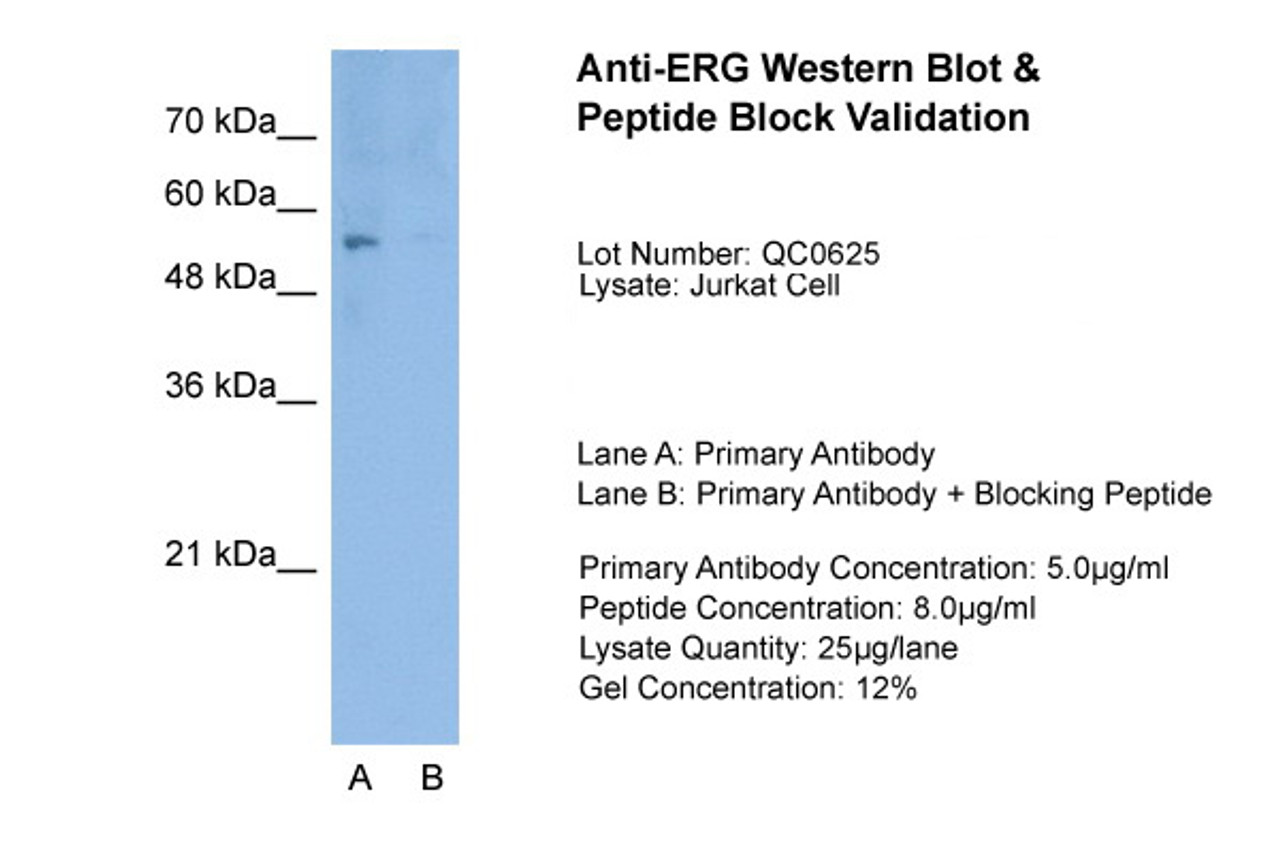Antibody used in WB on Jurkat 1.25 ug/ml (Lane A: Primary Antibody and Lane B: Primary Antibody + Blocking Peptide ) .