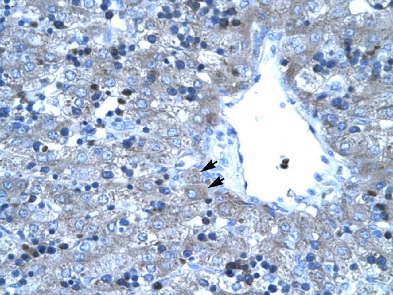 Antibody used in IHC on Human Liver.