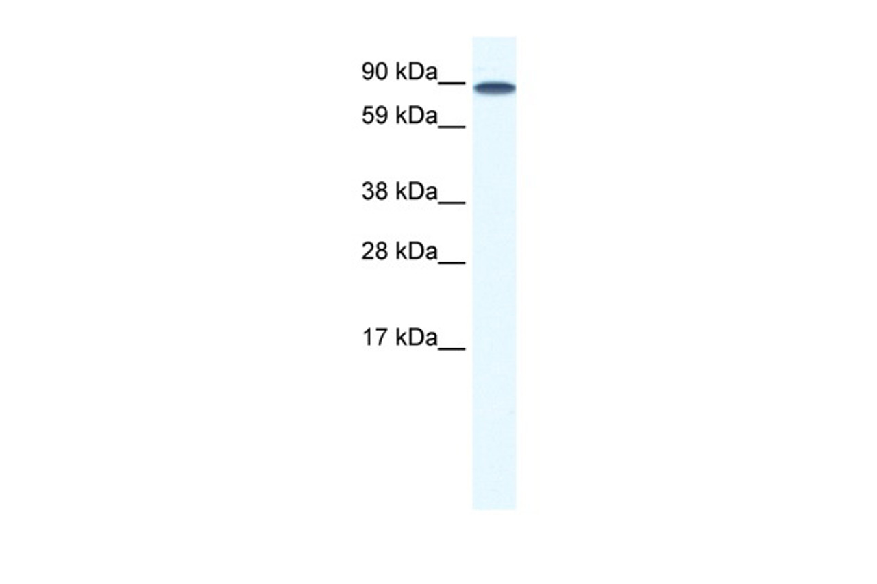 Antibody used in WB on Human Lung at 0.06 ug/ml.