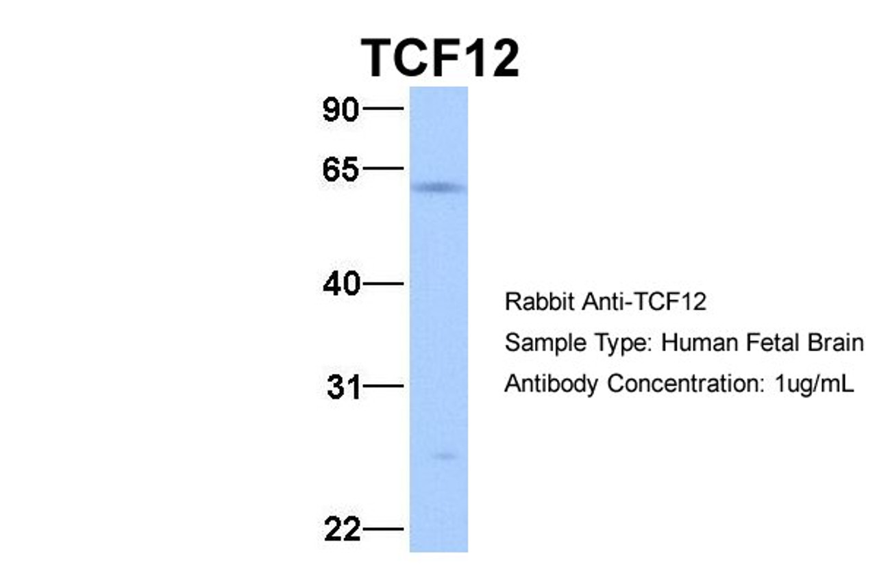 Antibody used in WB on Hum. Fetal Brain at 1 ug/ml.