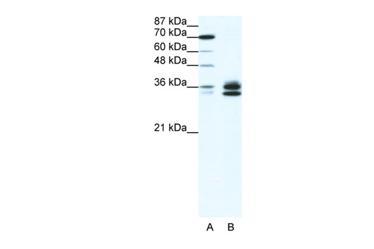 Antibody used in WB on Human HepG2 at 1 ug/ml.