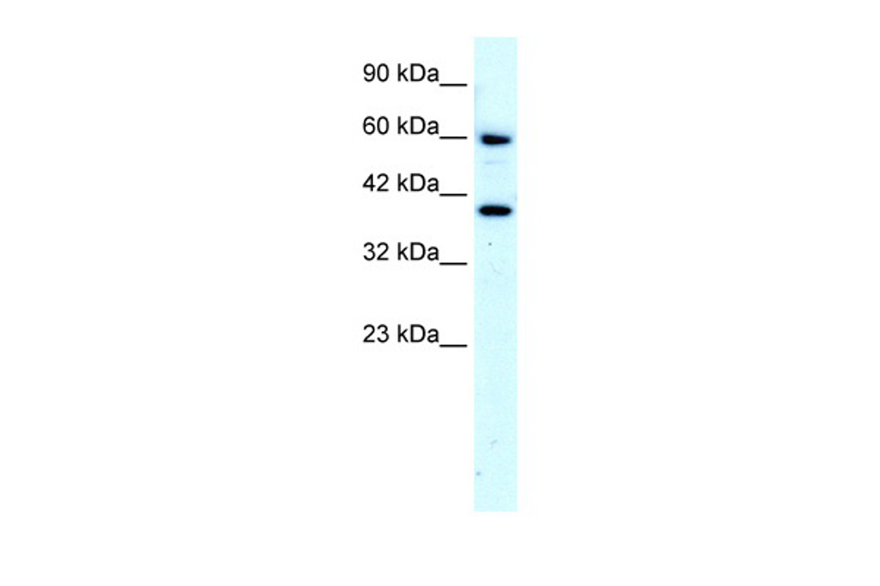 Antibody used in WB on Human HepG2 at 4.0 ug/ml.