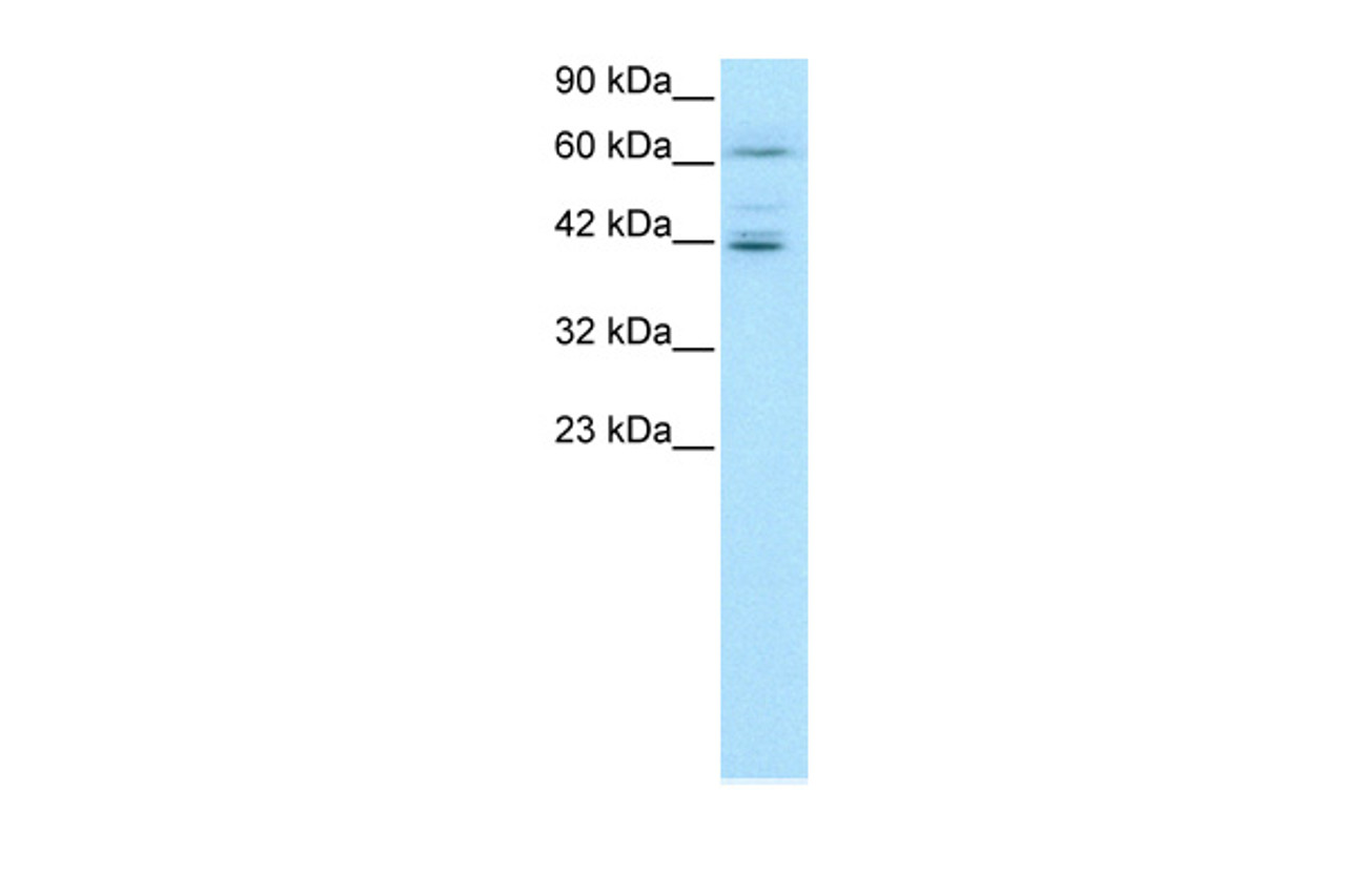 Antibody used in WB on Human Jurkat 0.2-1 ug/ml.