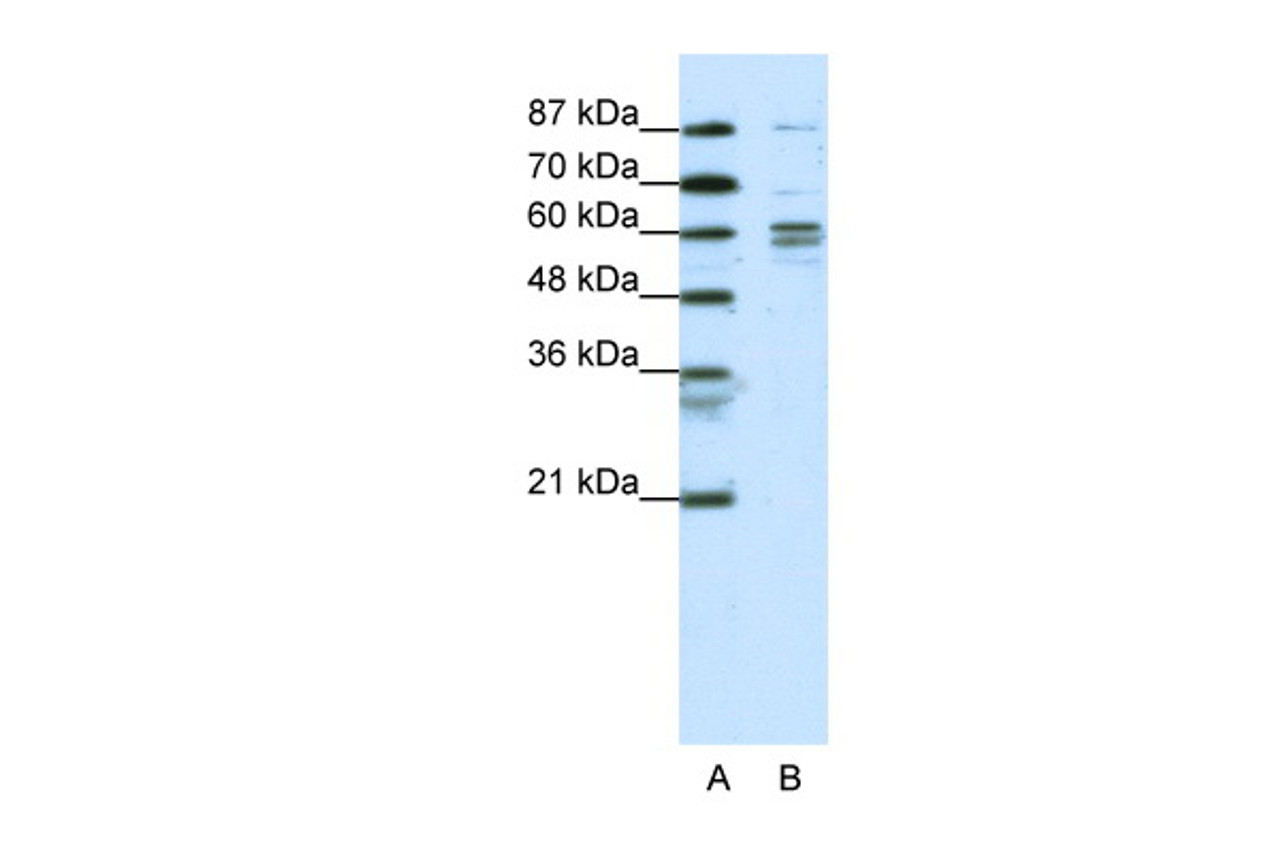 Antibody used in WB on Human K562 at 0.2-1 ug/ml.