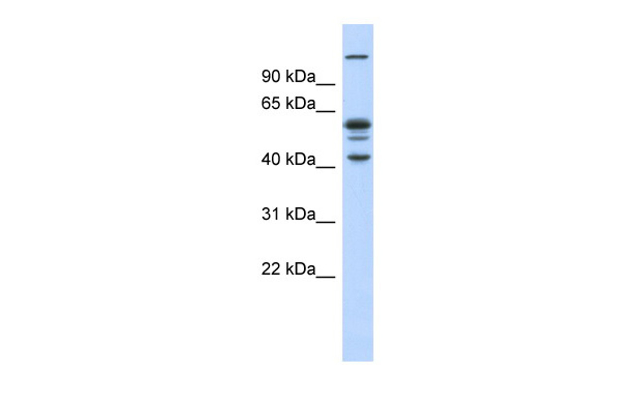 Antibody used in WB on Human Muscle at 0.2-1 ug/ml.