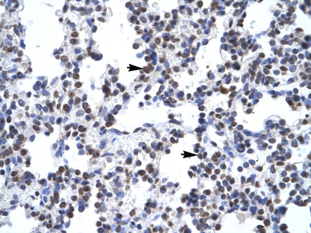 Antibody used in IHC on Human Lung.