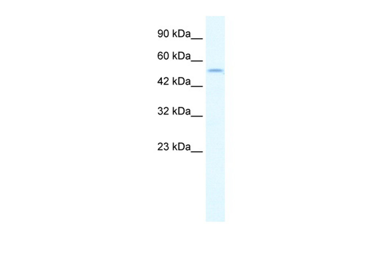 Antibody used in WB on Human Jurkat 1.25 ug/ml.