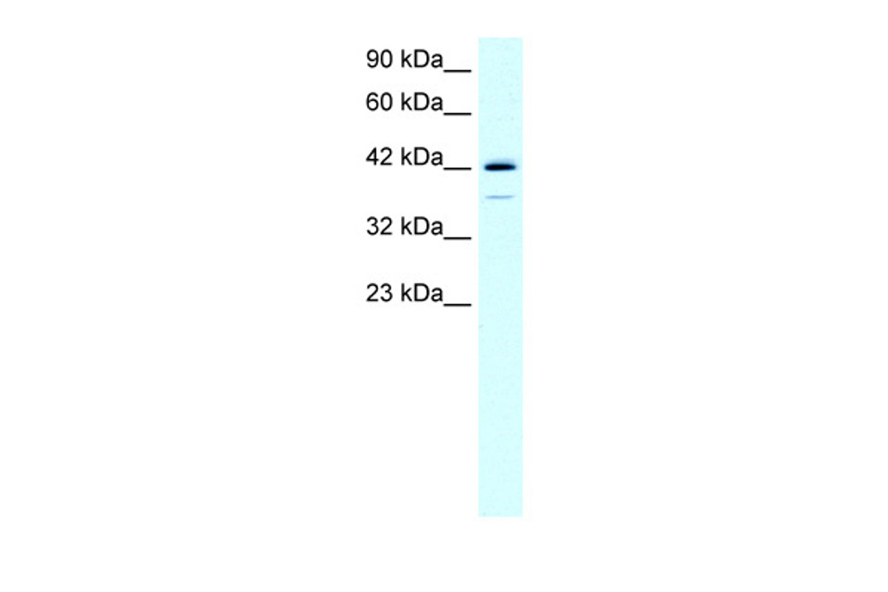 Antibody used in WB on Human HepG2 at 0.4 ug/ml.