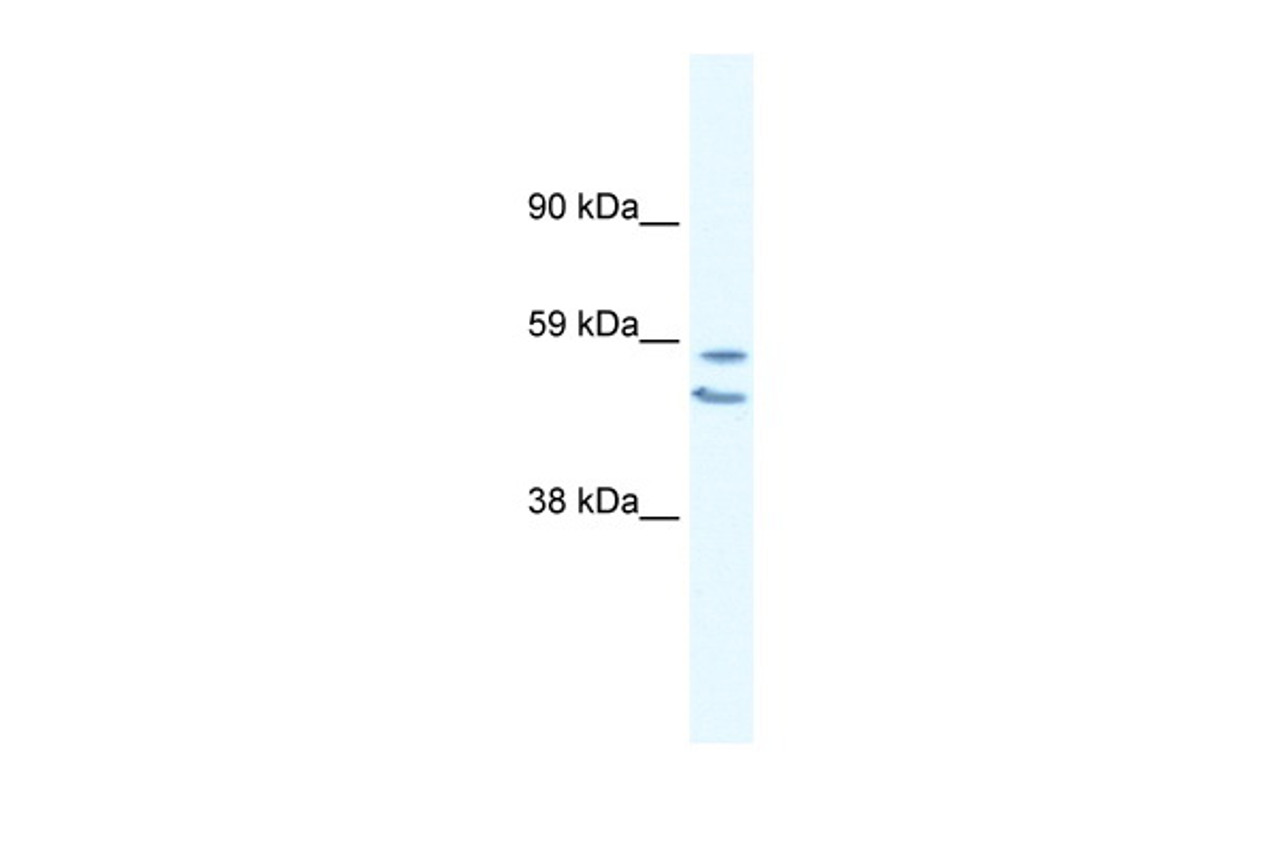 Antibody used in WB on Human Lung at 0.2-1 ug/ml.