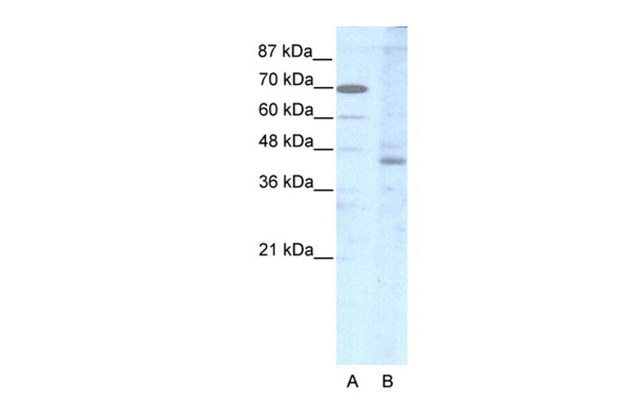 Antibody used in WB on Human HepG2 at 2.5 ug/ml.