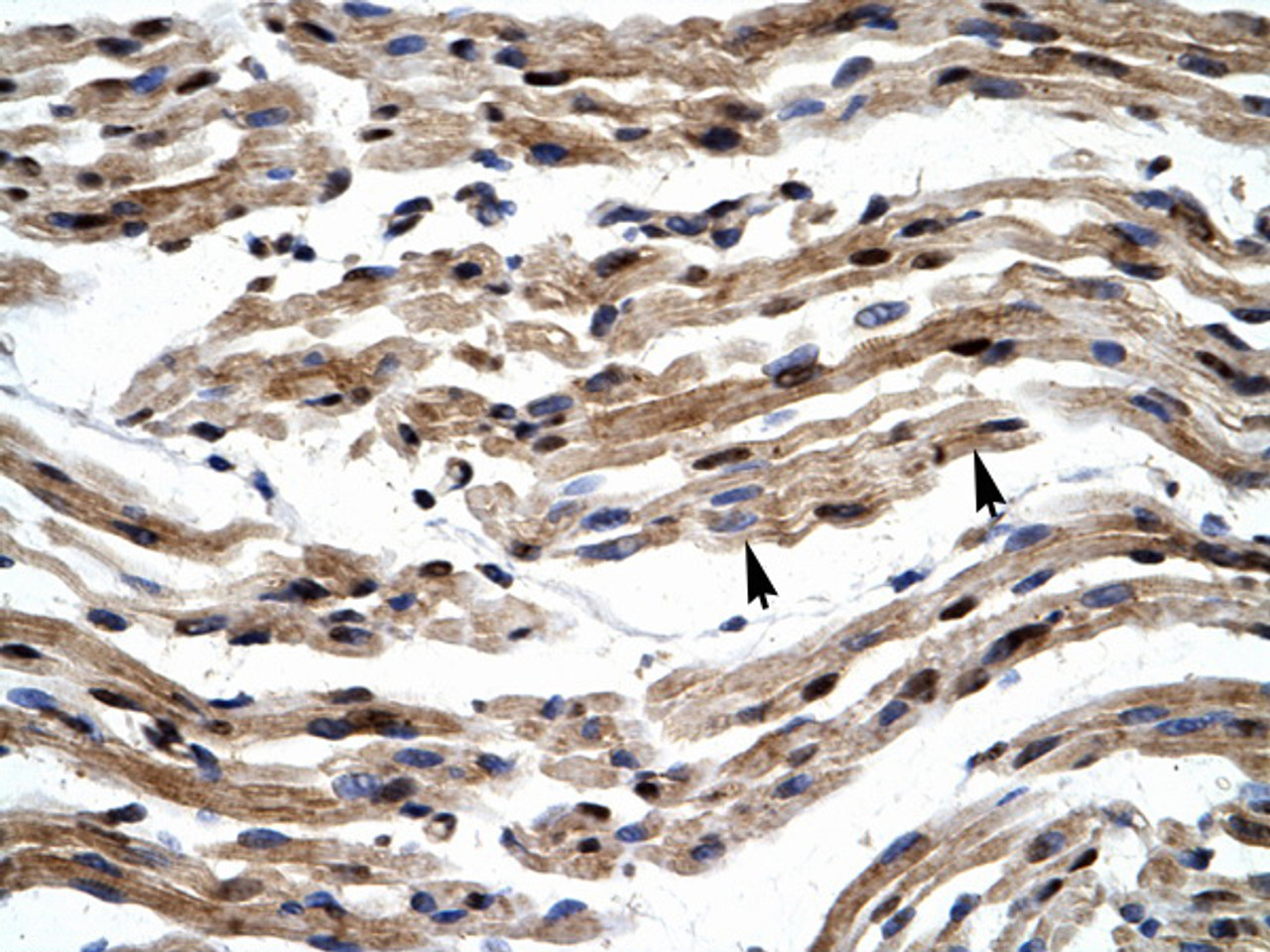 Antibody used in IHC on Human Muscle.