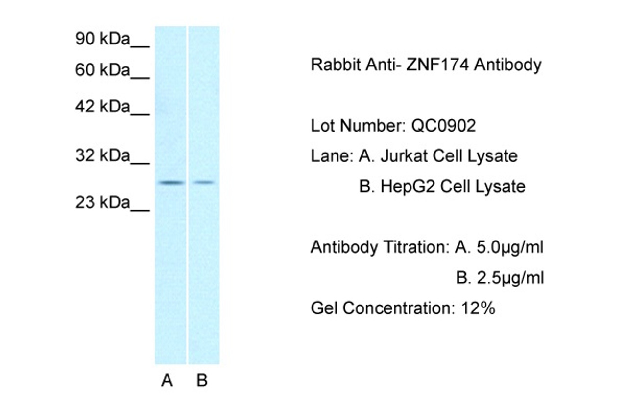 Antibody used in WB on Jurkat, HepG2 at 2.5 ug/ml (Lane A. Jurkat, Lane B. HepG2) .