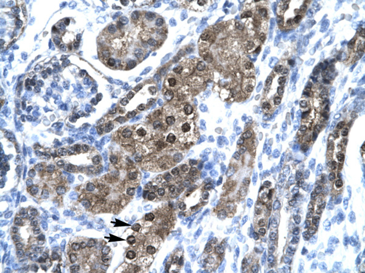 Antibody used in IHC on Human kidney.