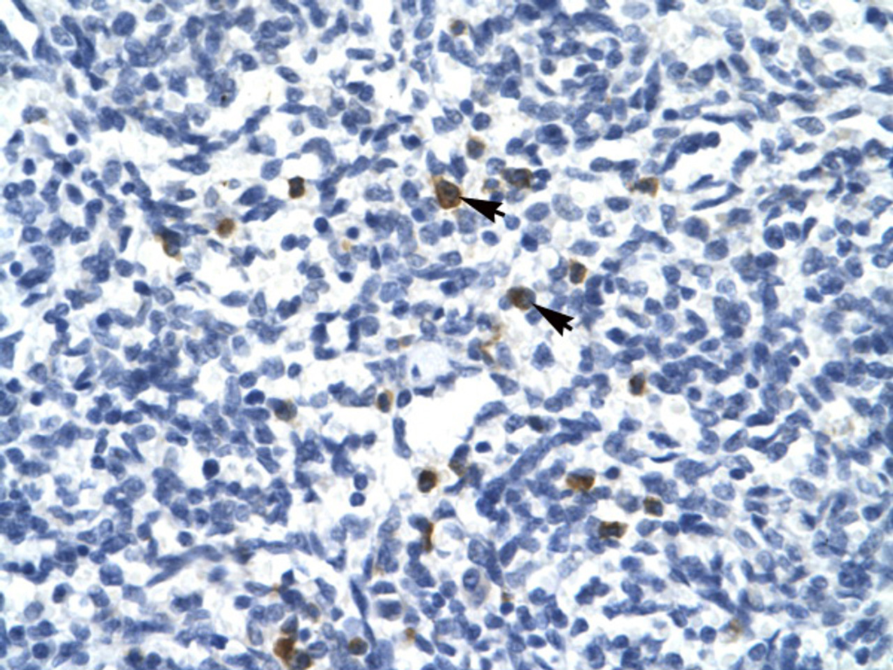 Antibody used in IHC on Human Spleen.