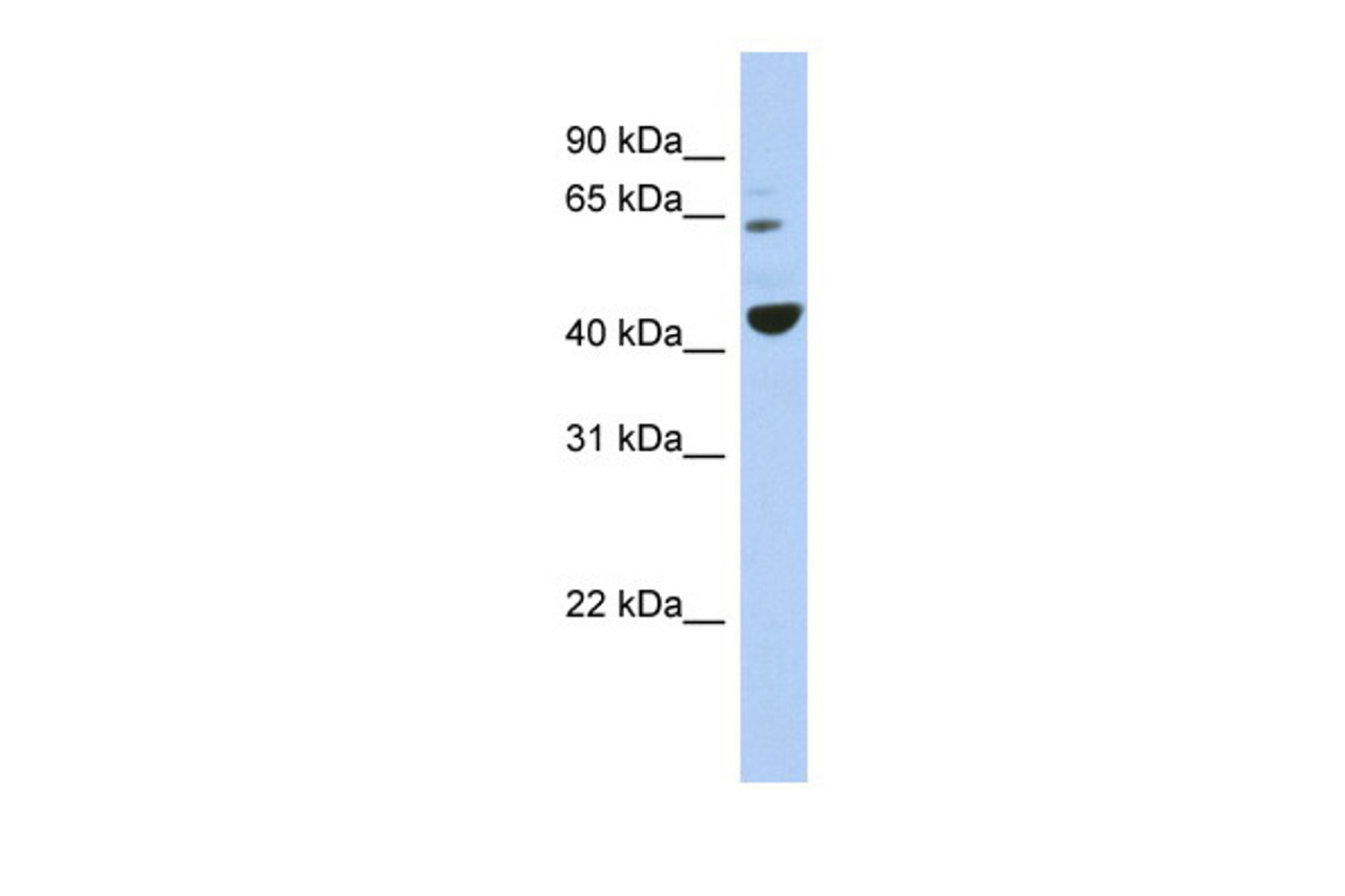 Antibody used in WB on Human NCI-H226 at 0.2-1 ug/ml.