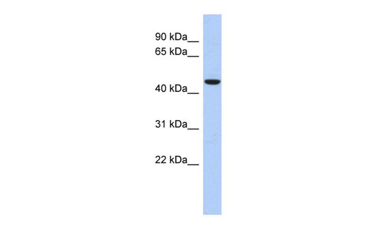Antibody used in WB on Human kidney at 0.2-1 ug/ml.