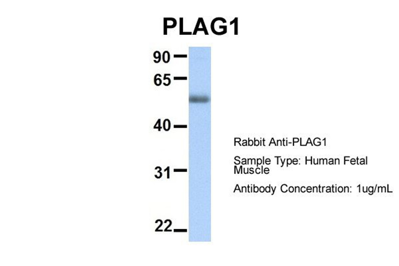Antibody used in WB on Hum. Fetal Muscle at 1 ug/ml.