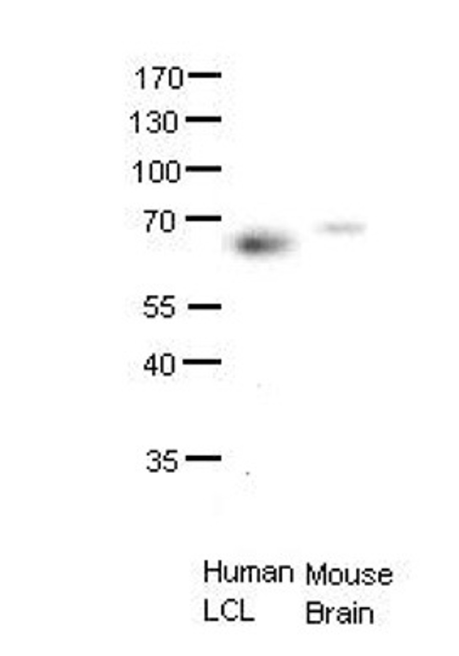 Antibody used in WB on human LCL, mouse brains at 1:1000.